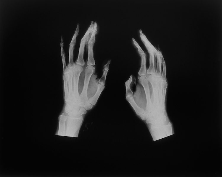Hand Series_o